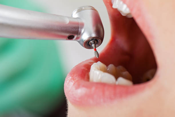Best Pediatric Emergency Dentist in Mill Hall, PA